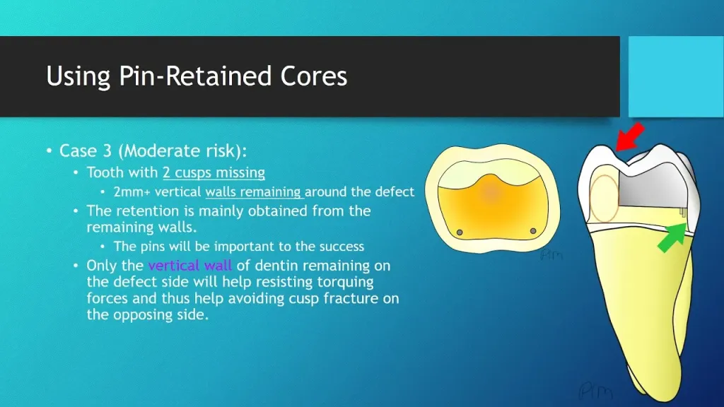 Crown Dental at Fred Morales blog